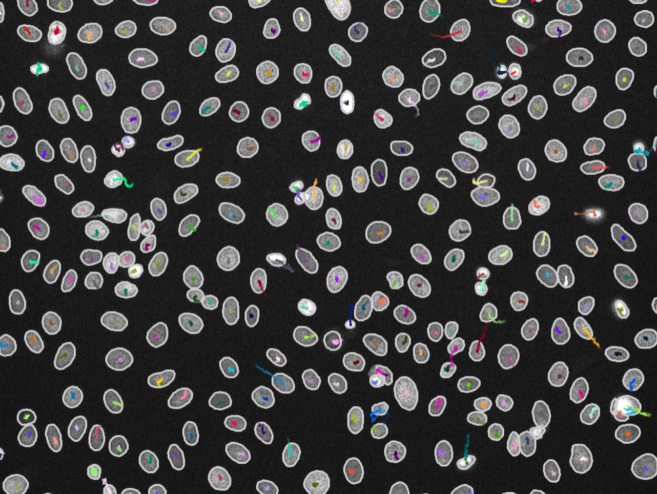 Tracking Visualisation