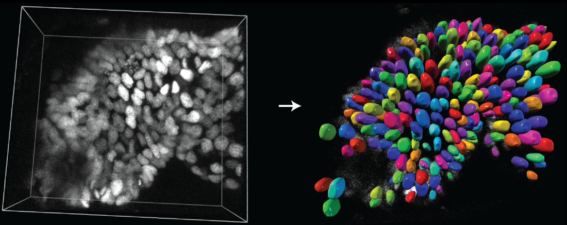 3D Segmentation Visualisation